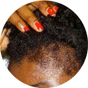 Cheveux plus forts, moins de casse