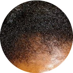 Pousse visible acceleree